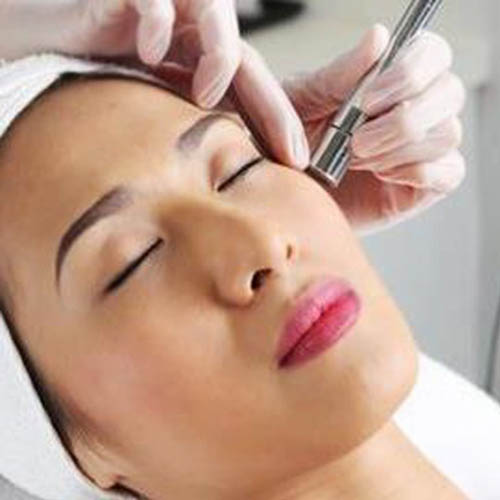 microdebrasion-500x500